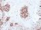 RB Binding Protein 7, Chromatin Remodeling Factor antibody, GTX109640, GeneTex, Immunohistochemistry paraffin image 
