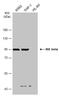 Inhibitor Of Nuclear Factor Kappa B Kinase Subunit Beta antibody, GTX634834, GeneTex, Western Blot image 