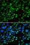 Thioredoxin domain-containing protein 5 antibody, STJ29454, St John