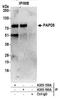 Terminal Nucleotidyltransferase 4B antibody, A305-159A, Bethyl Labs, Immunoprecipitation image 