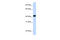 Fumarylacetoacetate Hydrolase antibody, 25-713, ProSci, Western Blot image 