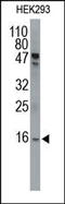 Small Ubiquitin Like Modifier 1 antibody, 200129, Abbiotec, Western Blot image 