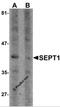 Diff6 antibody, 6903, ProSci, Western Blot image 