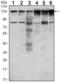 Protein Tyrosine Kinase 7 (Inactive) antibody, GTX82801, GeneTex, Western Blot image 