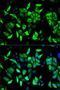 Ribonucleotide Reductase Regulatory Subunit M2 antibody, LS-C333948, Lifespan Biosciences, Immunofluorescence image 