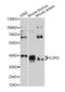 Interleukin 2 Receptor Subunit Gamma antibody, MBS126482, MyBioSource, Western Blot image 