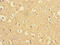 Presenilin 1 antibody, LS-C679213, Lifespan Biosciences, Immunohistochemistry paraffin image 