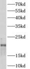 Actin Related Protein 2/3 Complex Subunit 3 antibody, FNab00602, FineTest, Western Blot image 