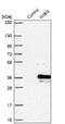 PYM Homolog 1, Exon Junction Complex Associated Factor antibody, NBP1-92596, Novus Biologicals, Western Blot image 