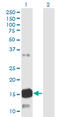 Ataxin 7 Like 1 antibody, LS-C139469, Lifespan Biosciences, Western Blot image 