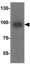 Run domain Beclin-1 interacting and cystein-rich containing protein antibody, GTX31593, GeneTex, Western Blot image 