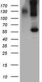 Bone Morphogenetic Protein 6 antibody, LS-C796296, Lifespan Biosciences, Western Blot image 