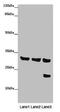 Solute Carrier Family 25 Member 10 antibody, CSB-PA883371LA01HU, Cusabio, Western Blot image 