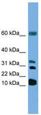 Leukotriene C4 Synthase antibody, TA330969, Origene, Western Blot image 