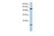 Oncostatin M Receptor antibody, GTX46449, GeneTex, Western Blot image 