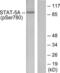 Signal Transducer And Activator Of Transcription 5A antibody, LS-C117484, Lifespan Biosciences, Western Blot image 