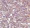 CD180 Molecule antibody, NBP1-76707, Novus Biologicals, Immunohistochemistry paraffin image 