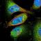 RB Binding Protein 9, Serine Hydrolase antibody, NBP1-88553, Novus Biologicals, Immunocytochemistry image 
