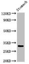 GLCLR antibody, orb400452, Biorbyt, Western Blot image 