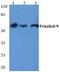 Frizzled Class Receptor 9 antibody, PA5-75513, Invitrogen Antibodies, Western Blot image 