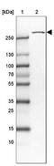 Ubiquitin Specific Peptidase 24 antibody, NBP1-82943, Novus Biologicals, Western Blot image 