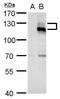 AXL Receptor Tyrosine Kinase antibody, GTX129406, GeneTex, Western Blot image 