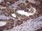 RNA Transcription, Translation And Transport Factor antibody, LS-C338991, Lifespan Biosciences, Immunohistochemistry paraffin image 