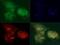 DEP Domain Containing MTOR Interacting Protein antibody, PA5-72954, Invitrogen Antibodies, Immunofluorescence image 
