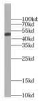 BCS1 Homolog, Ubiquinol-Cytochrome C Reductase Complex Chaperone antibody, FNab00857, FineTest, Western Blot image 