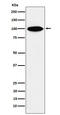 Kinesin-associated protein 3 antibody, M07239, Boster Biological Technology, Western Blot image 