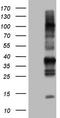 Transforming Acidic Coiled-Coil Containing Protein 2 antibody, TA804442, Origene, Western Blot image 