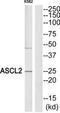 Achaete-Scute Family BHLH Transcription Factor 2 antibody, TA313480, Origene, Western Blot image 