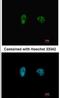 Checkpoint Kinase 2 antibody, NB100-500, Novus Biologicals, Immunofluorescence image 