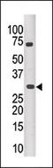 Pim-3 Proto-Oncogene, Serine/Threonine Kinase antibody, 62-703, ProSci, Western Blot image 