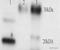 Ferritin Light Chain antibody, ab69090, Abcam, Western Blot image 