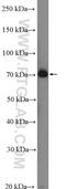 Complement C2 antibody, 27175-1-AP, Proteintech Group, Western Blot image 