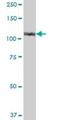 Ubiquitin Like Modifier Activating Enzyme 7 antibody, H00007318-B01P, Novus Biologicals, Western Blot image 