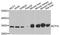 Electron transfer flavoprotein subunit alpha, mitochondrial antibody, STJ29983, St John