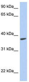 Radial Spoke Head 14 Homolog antibody, TA334537, Origene, Western Blot image 