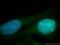 Cyclin Dependent Kinase 2 antibody, 10122-1-AP, Proteintech Group, Immunofluorescence image 