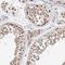 XRCC5 antibody, HPA025813, Atlas Antibodies, Immunohistochemistry frozen image 