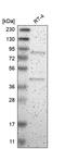 Rho Guanine Nucleotide Exchange Factor 16 antibody, PA5-52713, Invitrogen Antibodies, Western Blot image 