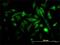RAB3B, Member RAS Oncogene Family antibody, H00005865-M01, Novus Biologicals, Immunofluorescence image 