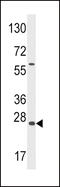 Growth Arrest And DNA Damage Inducible Alpha antibody, MBS9204989, MyBioSource, Western Blot image 