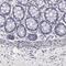 Tectonin Beta-Propeller Repeat Containing 2 antibody, PA5-51435, Invitrogen Antibodies, Immunohistochemistry paraffin image 