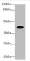 Lysophosphatidic Acid Receptor 4 antibody, A62886-100, Epigentek, Western Blot image 