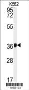 Neutrophil Cytosolic Factor 4 antibody, MBS9204984, MyBioSource, Western Blot image 