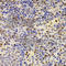 PR/SET Domain 5 antibody, A7361, ABclonal Technology, Immunohistochemistry paraffin image 