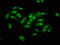 NOP2/Sun RNA Methyltransferase 2 antibody, CSB-PA626626LA01HU, Cusabio, Immunofluorescence image 