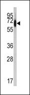 Albumin antibody, PA5-13476, Invitrogen Antibodies, Western Blot image 